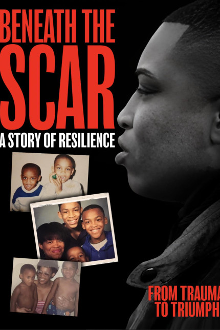 /watch-movie/beneath-the-scar-a-story-of-resilience